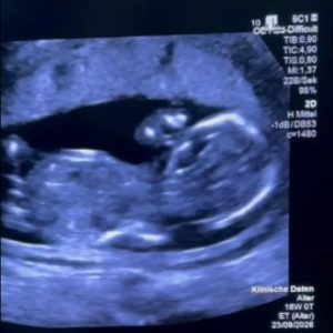 672182301 26367271899632542 9155863517583703225 n - Starea de sanatate