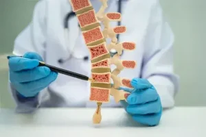 Inovație în tratamentul osteoporozei: Molecula care construiește os nou și întărește mușchii 6 - Starea de sanatate download - Starea de sanatate